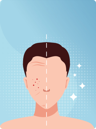 botulinum toxin
