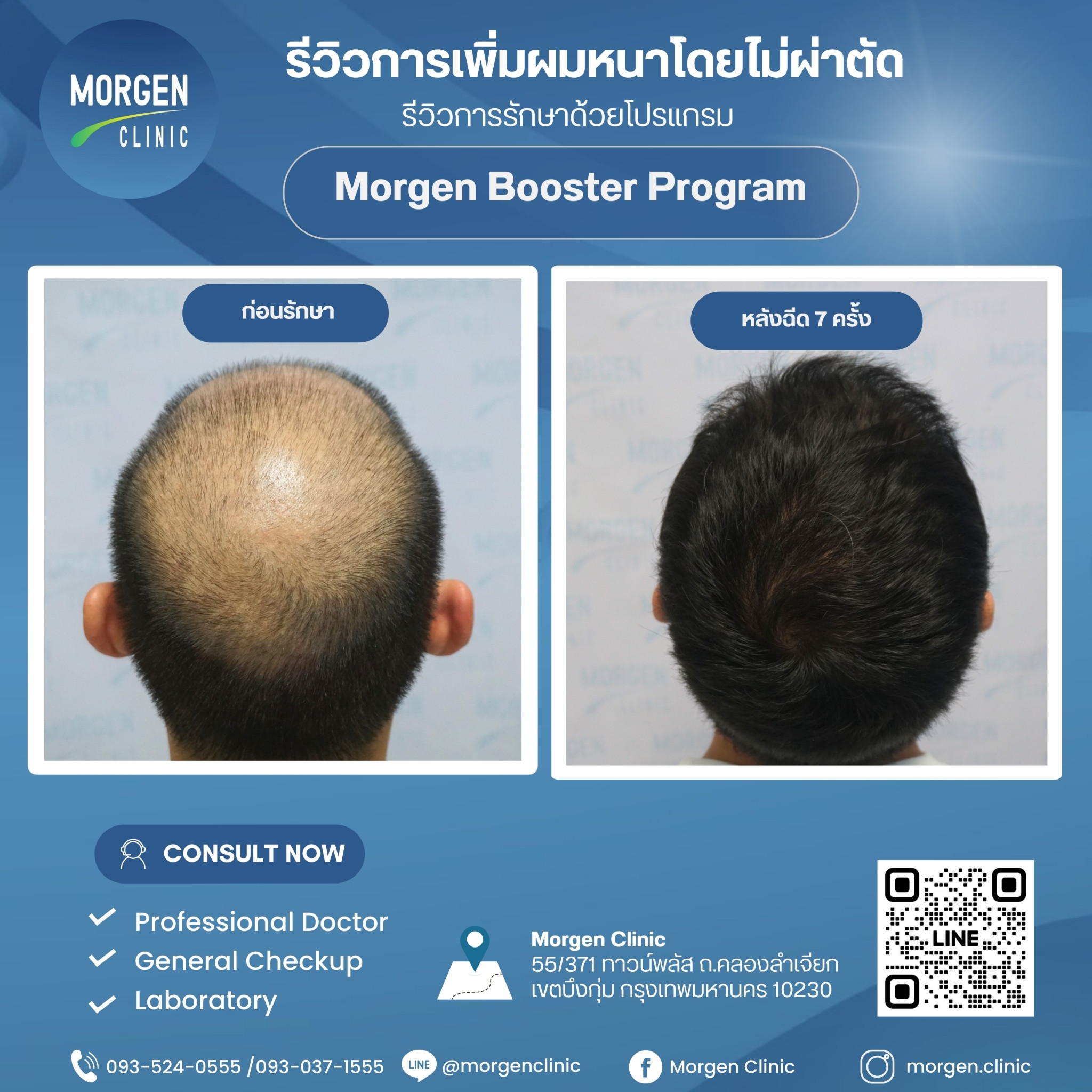 รีวิว Morgen Booster Program