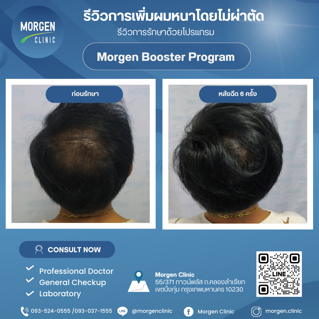 รีวิว Morgen Booster Program