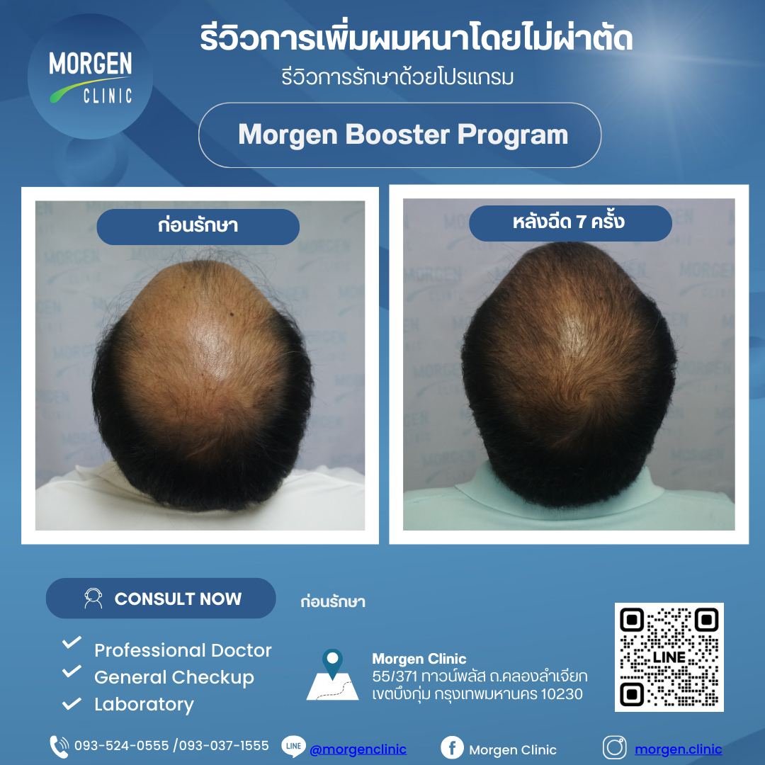 รีวิว Morgen Booster Program